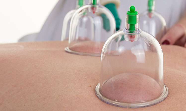MASSAGE CUPPING TECHNIQUE AS AN OPPORTUNITY FOR PROFESSIONAL GROWTH