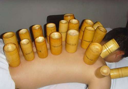 Bamboo Cupping1