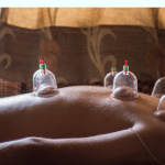 dry-cupping-therapy-500x500