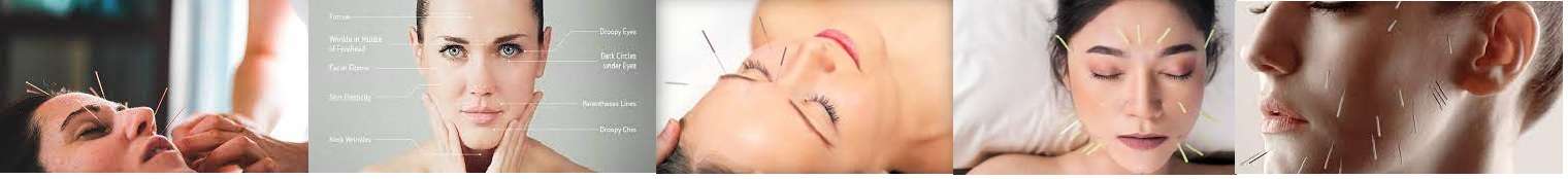 Acufacial Cosmetic Acupuncture