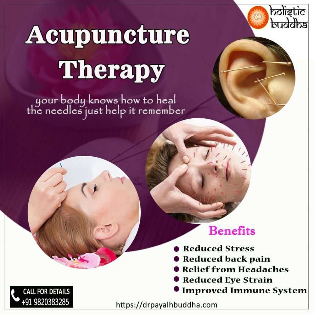 Acupuncture therapy banner