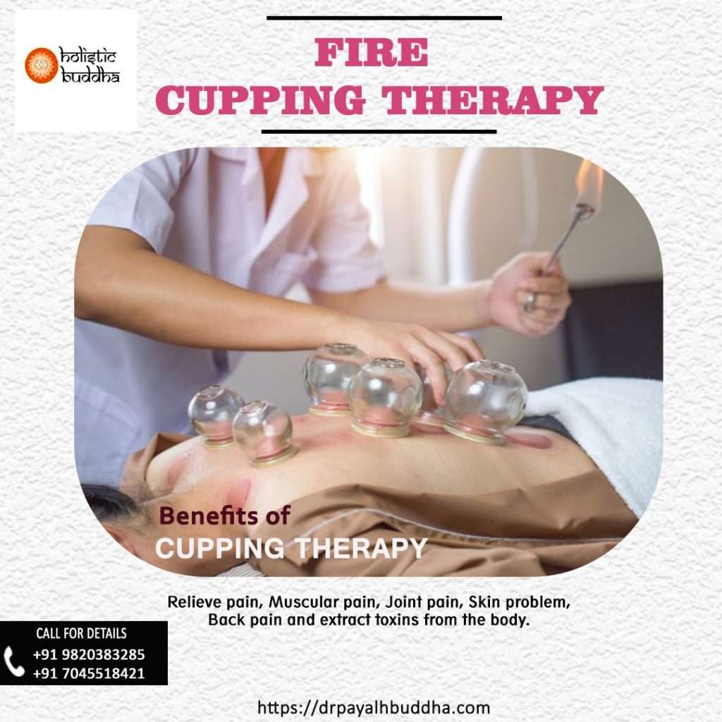 Fire cupping therapy for Blood Purifying and Pain relief