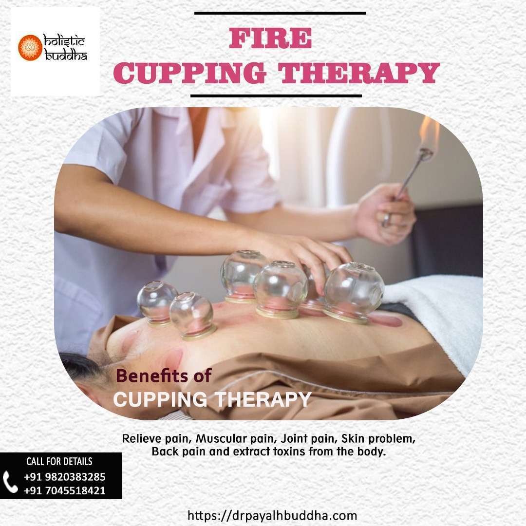 Fire cupping therapy for Blood Purifying and Pain relief