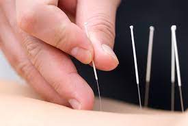 How does acupuncture work?