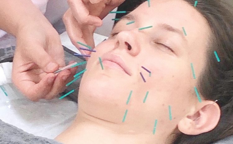  Advanced Acu-facial therapy with Cosmetic Acupuncture